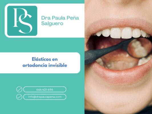 elasticos ortodoncia invisible