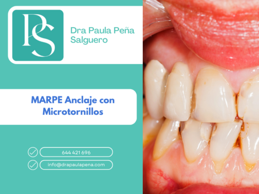 MARPE-ortodoncia-Málaga