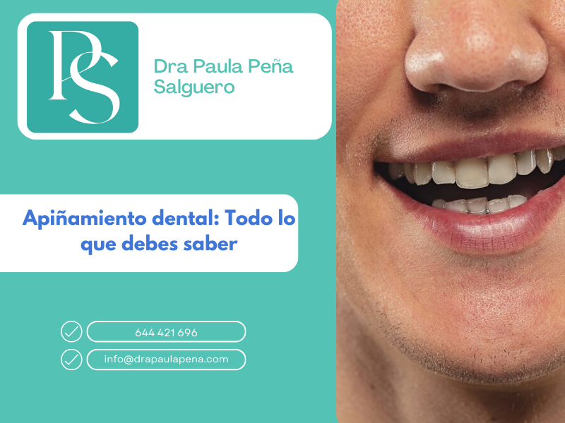 Apiñamiento dental